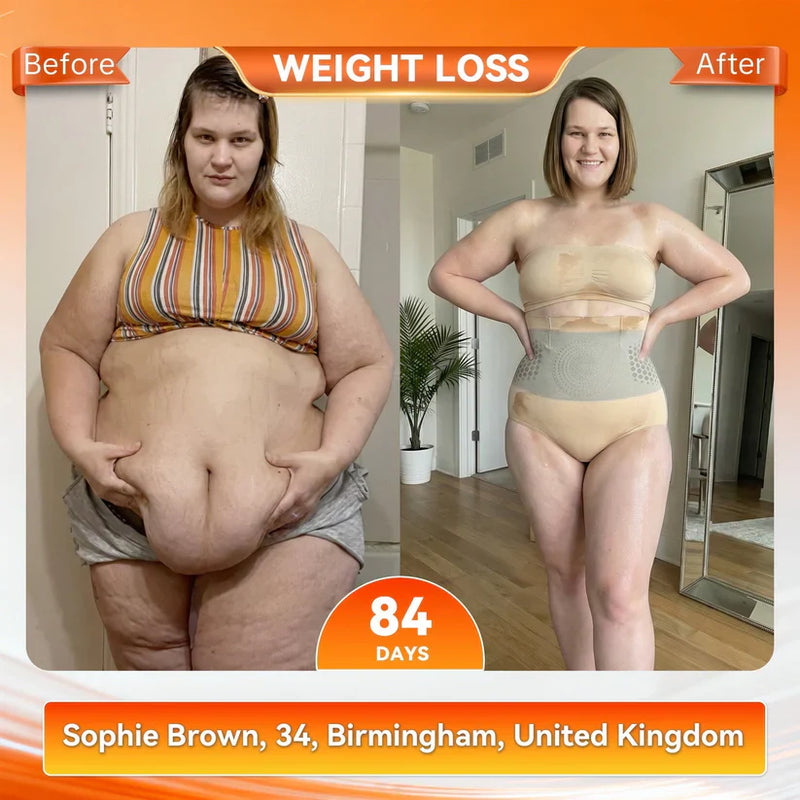 👙𝐎𝐟𝐟𝐢𝐜𝐢𝐚𝐥 𝐁𝐫𝐚𝐧𝐝 𝐒𝐭𝐨𝐫𝐞 | 4-In-1 Sculpting & Fat-Burn Shorts