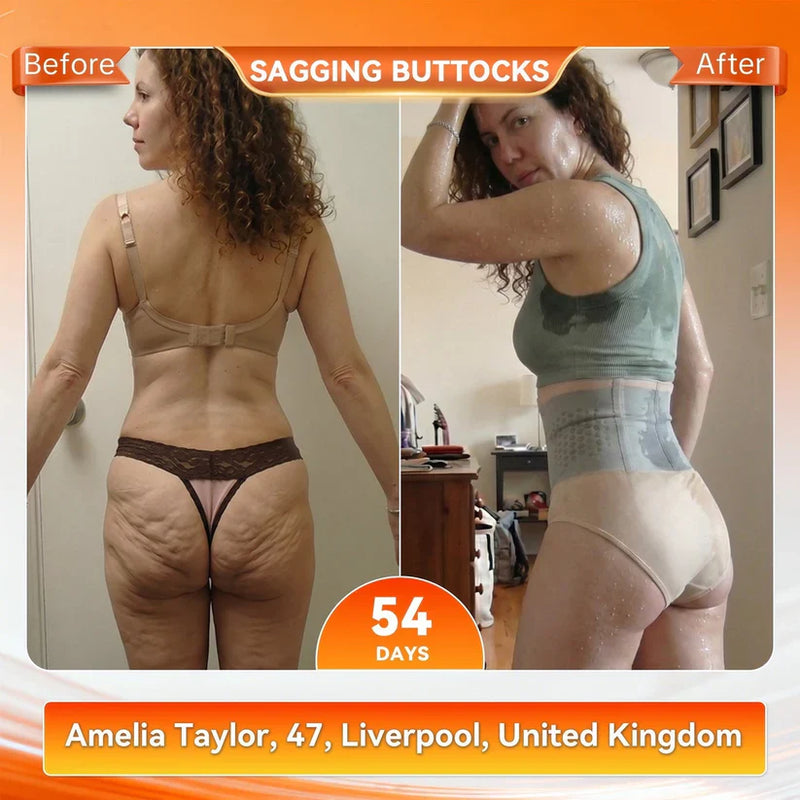 👙𝐎𝐟𝐟𝐢𝐜𝐢𝐚𝐥 𝐁𝐫𝐚𝐧𝐝 𝐒𝐭𝐨𝐫𝐞 | 4-In-1 Sculpting & Fat-Burn Shorts