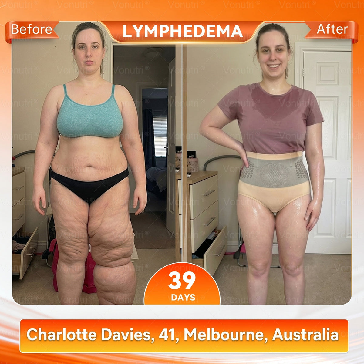 👙𝐎𝐟𝐟𝐢𝐜𝐢𝐚𝐥 𝐁𝐫𝐚𝐧𝐝 𝐒𝐭𝐨𝐫𝐞 | 4-In-1 Sculpting & Fat-Burn Shorts